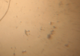 Vidéo 622 version MPG bactérie vue au microscope